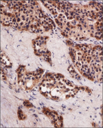 HB9 Antibody in Immunohistochemistry (Paraffin) (IHC (P))