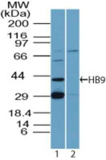 HB9 Antibody in Western Blot (WB)