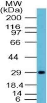 Influenza A H1N1 NA Polyclonal Antibody