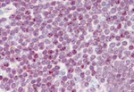 Histone H2A.X Antibody in Immunohistochemistry (Paraffin) (IHC (P))