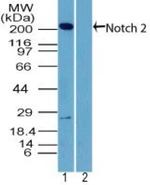 NOTCH2 Polyclonal Antibody