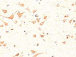 OLIG2 Antibody in Immunohistochemistry (Paraffin) (IHC (P))