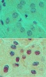 HNF6 Polyclonal Antibody