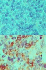 Importin 7 Polyclonal Antibody