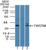 TWISTNB Polyclonal Antibody
