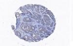 Coronin 3 Polyclonal Antibody