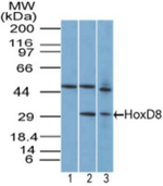 HOXD8 Polyclonal Antibody
