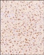 SNAIL Polyclonal Antibody