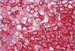 NUMB Antibody in Immunohistochemistry (Paraffin) (IHC (P))