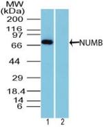 NUMB Antibody in Western Blot (WB)
