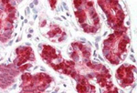 RIG-I Antibody in Immunohistochemistry (Paraffin) (IHC (P))