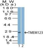 TMEM123 Polyclonal Antibody