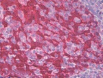 14-3-3 sigma Antibody in Immunohistochemistry (Paraffin) (IHC (P))