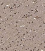 METT10D Antibody in Immunohistochemistry (Paraffin) (IHC (P))