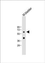 METT10D Antibody in Western Blot (WB)