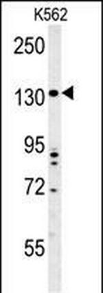 TMEM132D Polyclonal Antibody