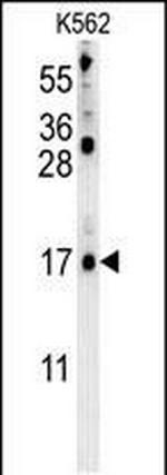 LCE2B Polyclonal Antibody
