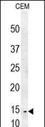 CRCT1 Antibody in Western Blot (WB)
