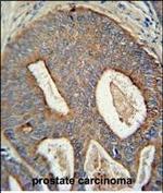 POTEB Antibody in Immunohistochemistry (Paraffin) (IHC (P))