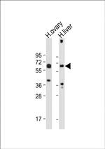 POTEB Antibody in Western Blot (WB)