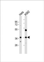 CTDSPL Polyclonal Antibody