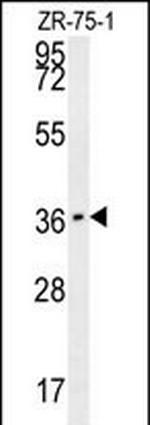 CLEC12A Polyclonal Antibody