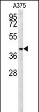SLC35B2 Antibody in Western Blot (WB)