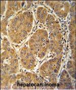 MCEE Polyclonal Antibody