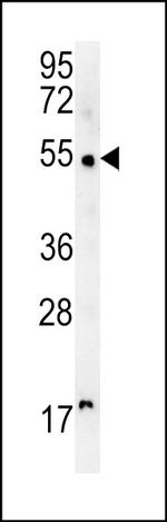 SCARA5 Antibody in Western Blot (WB)