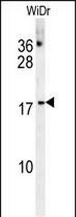 CHCHD2 Antibody in Western Blot (WB)
