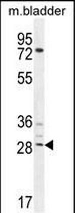 AKIP1 Polyclonal Antibody