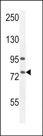 ALOX12B Antibody in Western Blot (WB)