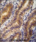 Angiopoietin 2 Polyclonal Antibody