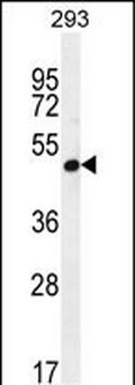 A4GALT Polyclonal Antibody