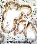 BTG2 Polyclonal Antibody