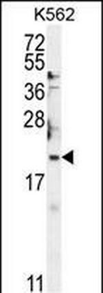 BTG2 Antibody in Western Blot (WB)