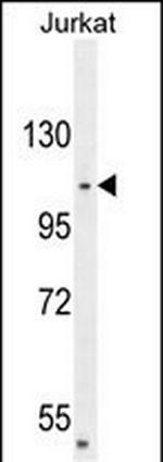 CENPC Polyclonal Antibody
