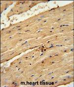 TIMP4 Polyclonal Antibody