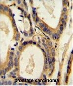 CCL4 Polyclonal Antibody