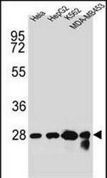 CHPT1 Polyclonal Antibody