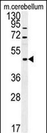 FUS Antibody in Western Blot (WB)