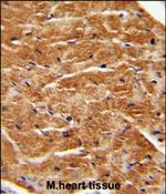 KGF Polyclonal Antibody