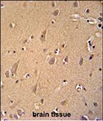 GCC2 Polyclonal Antibody