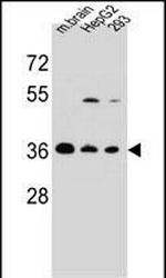 FBXO2 Polyclonal Antibody