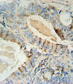 GCNT2 Polyclonal Antibody