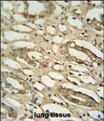 GGTLC2 Polyclonal Antibody
