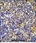 IKAROS Polyclonal Antibody