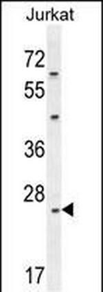 Claudin 22 Antibody in Western Blot (WB)
