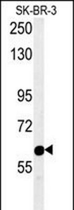 RADIL Antibody in Western Blot (WB)