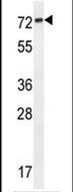 KLHL23 Antibody in Western Blot (WB)